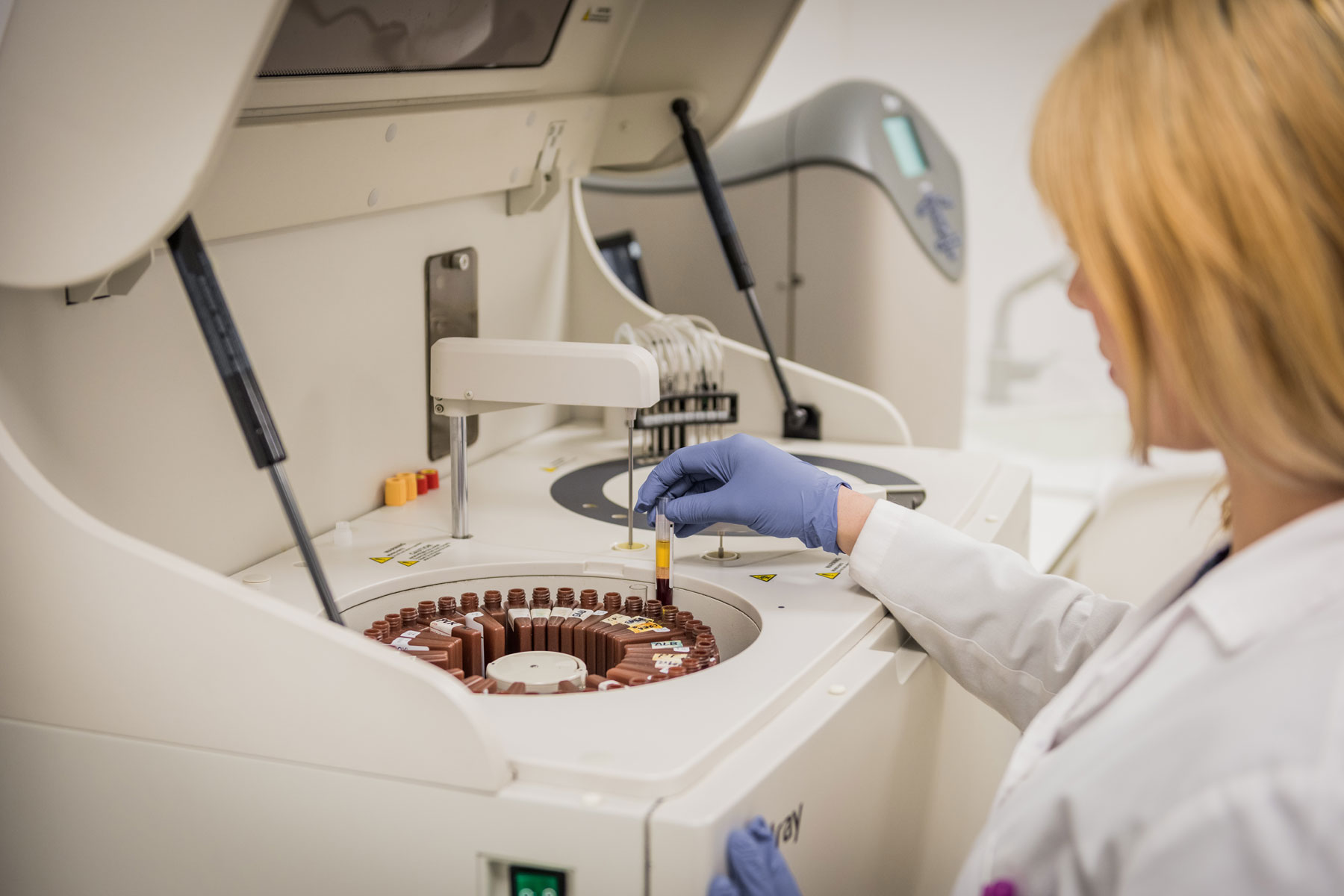 Análisis clínicos y toma de muestras en Laboratorio Clínico Roma Durango